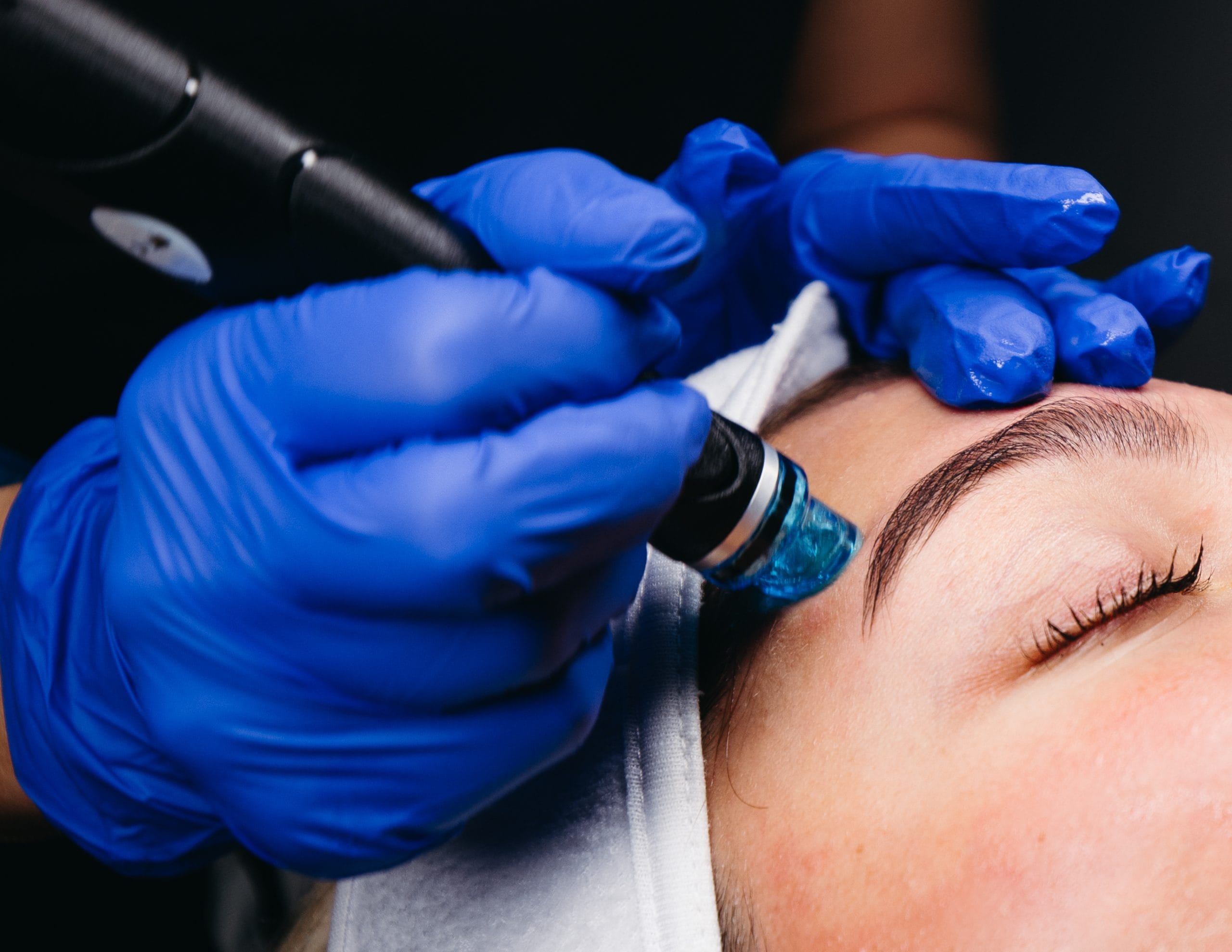 Hydrafacials 4 285884 scaled