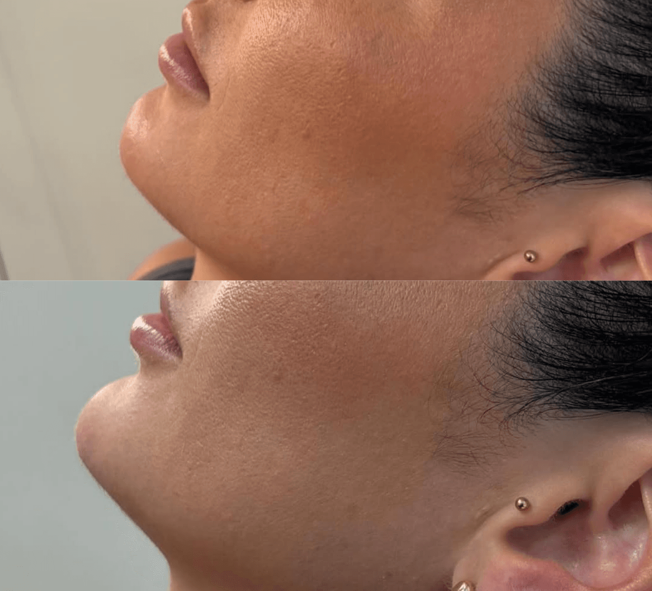 Filler 4 Services Images 1