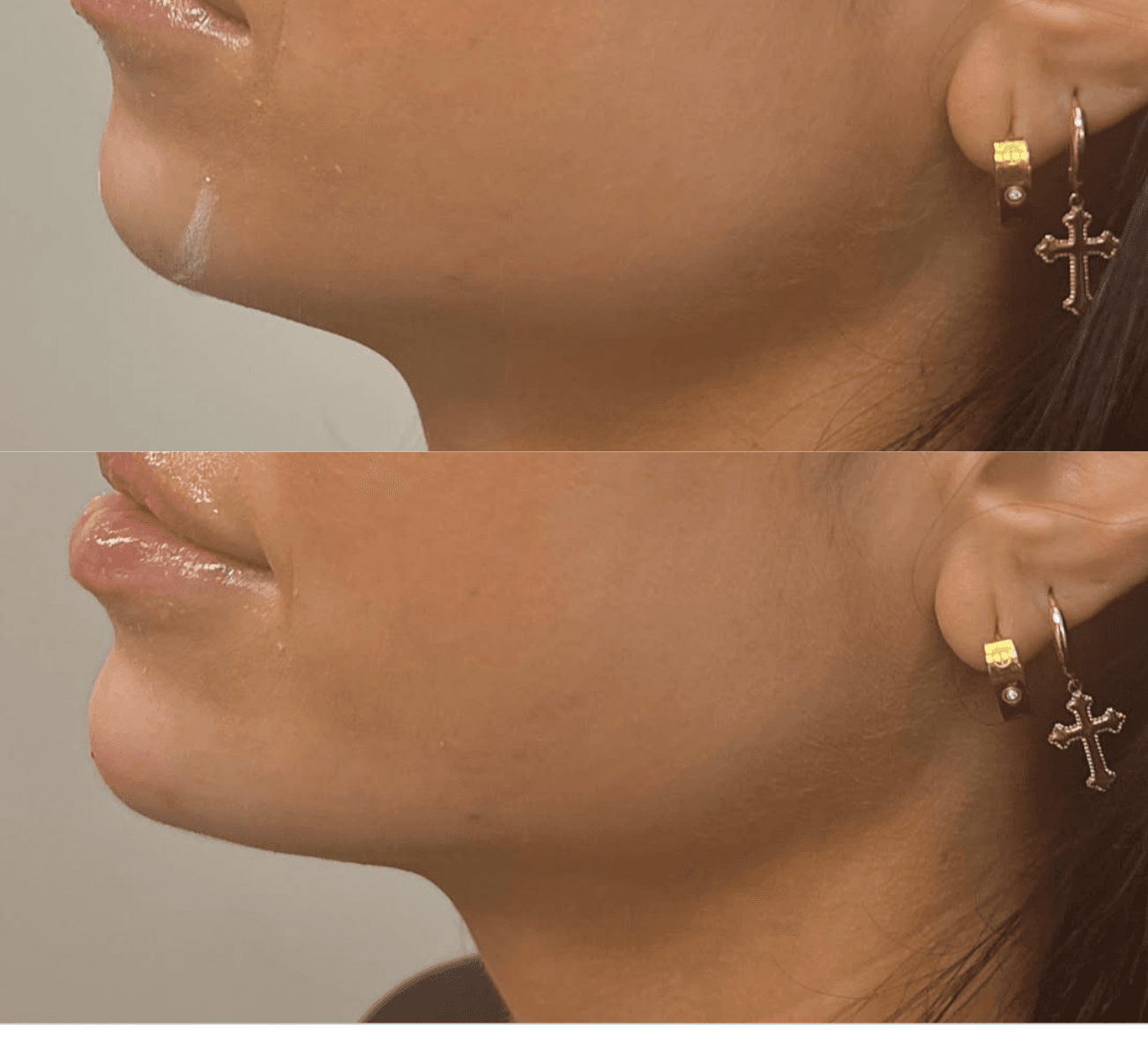 Filler 6 Services Images